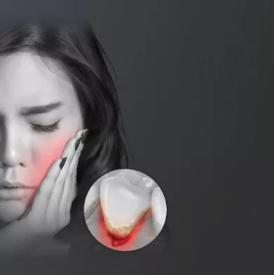 Ultrasonic fogtisztító